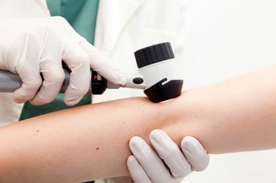 Nechte si vyšetřit znaménka